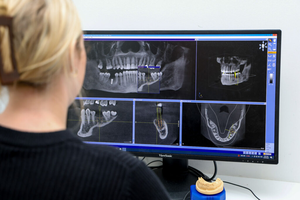 Dental nurse reviewing digital X-rays and scans for full mouth restoration planning at South Street Dental Perth